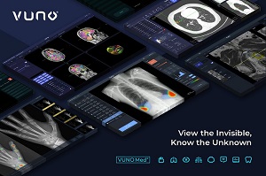 치매 찾아내는 AI, 뇌 MRI 영상 기반으로 알츠하이머 질환 가능성 찾아