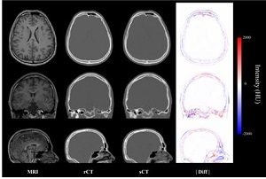 [테크 노트] 인공지능 기술로 방사선 노출 없이 CT 영상 얻는다