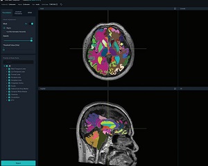 뷰노, AI 기반 뇌 정량화 의료기기 뷰노메드 딥브레인 기술 2건 특허 등록해